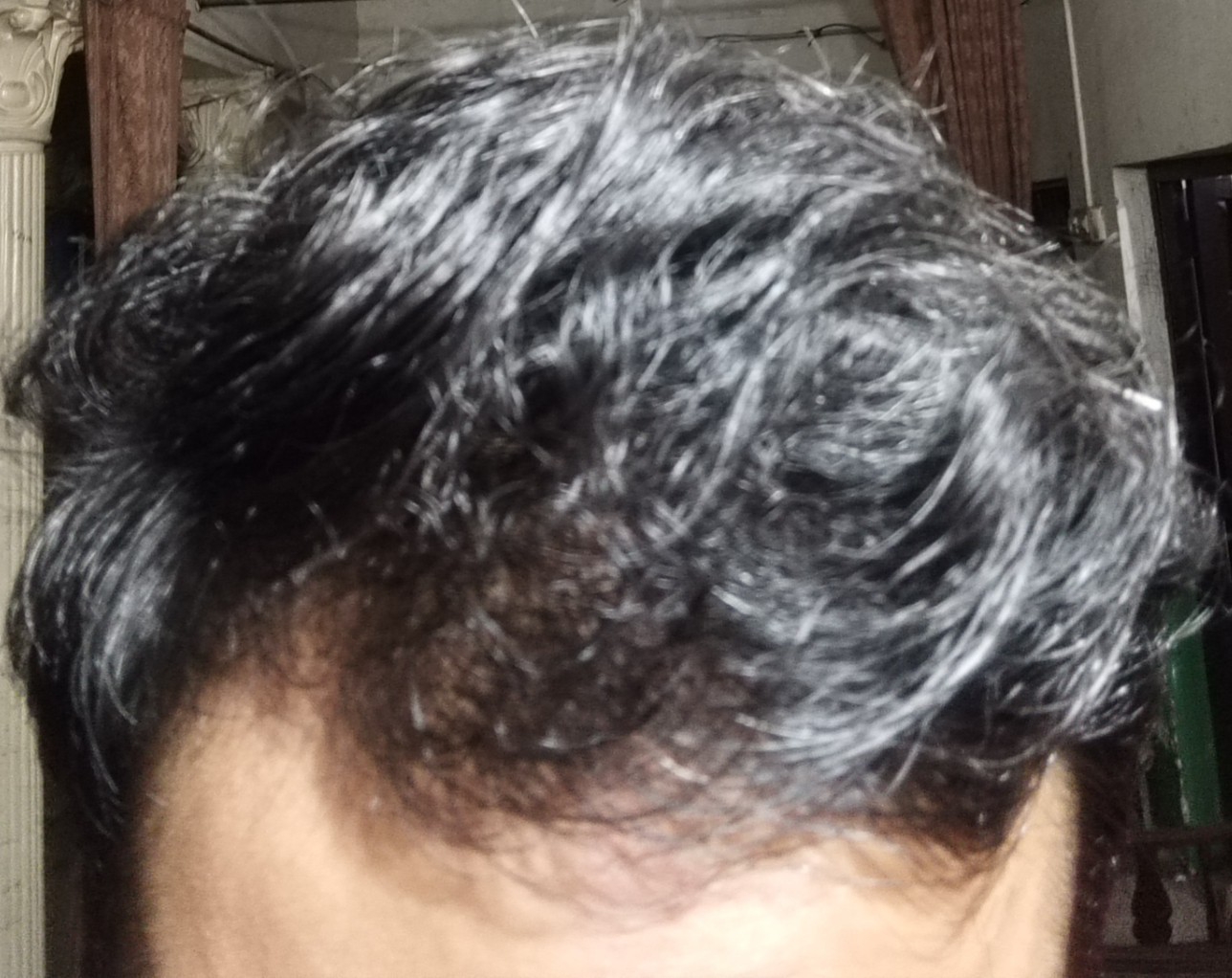 1000039089